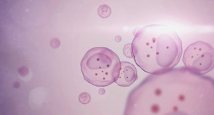 Asset_small_slide_ge_cic_960px_517px_1